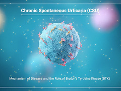 Watch overview of BTK and Mechanisms That Drive CSU Play video.