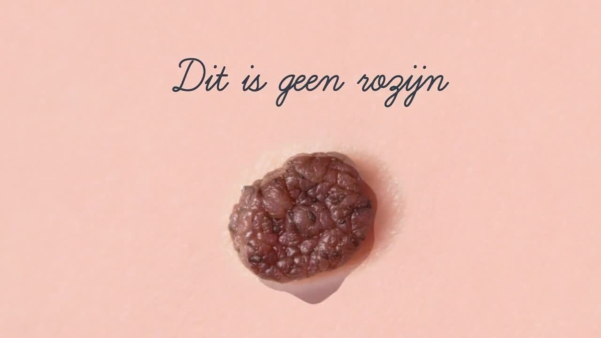 novartis.be melanome animation 2 NL