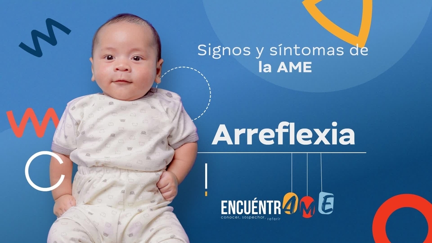 AME_Arreflexia_260224