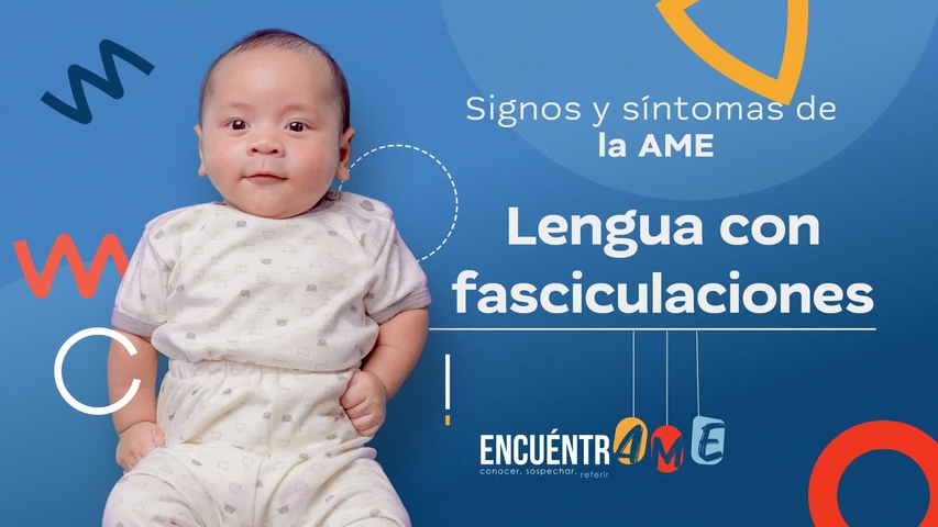AME-Lengua_fasciculaciones_260224