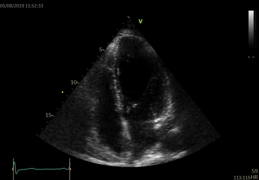 Kazuistiky z III. Cyklu - Nechme srdce bít_5_kazuistika_Video_5A_Dr_Hlubocka