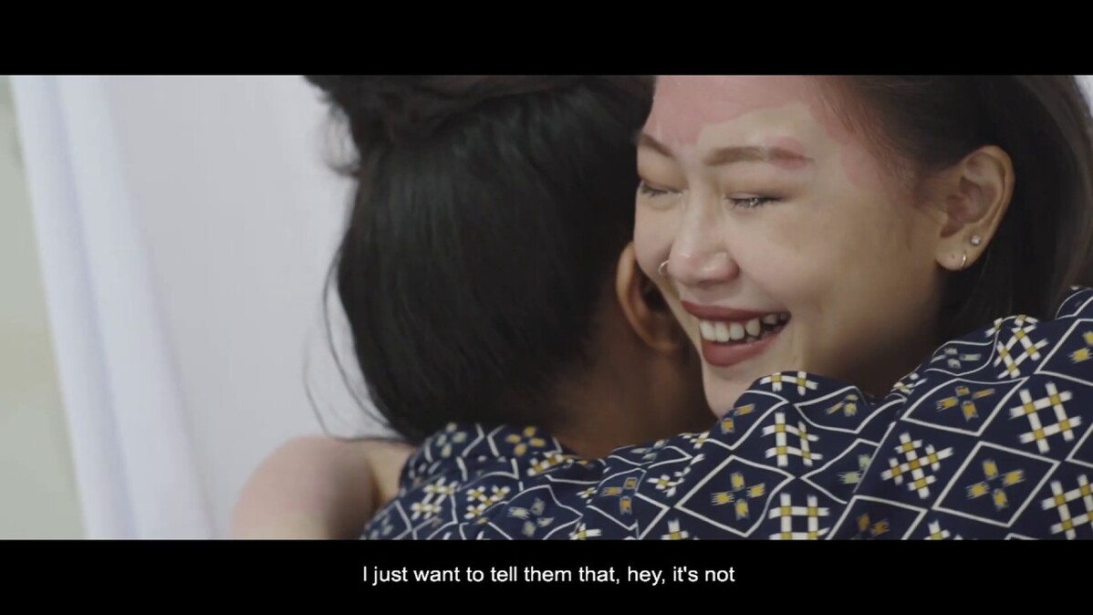 Novartis Psoriasis Sharing Session With Zee Avi