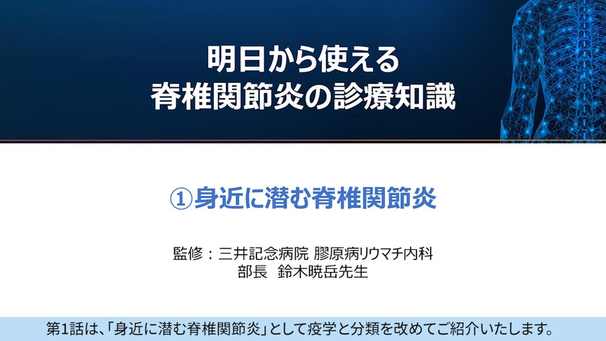 明日から使える脊椎関節炎の診療知識　①身近に潜む脊椎関節炎
