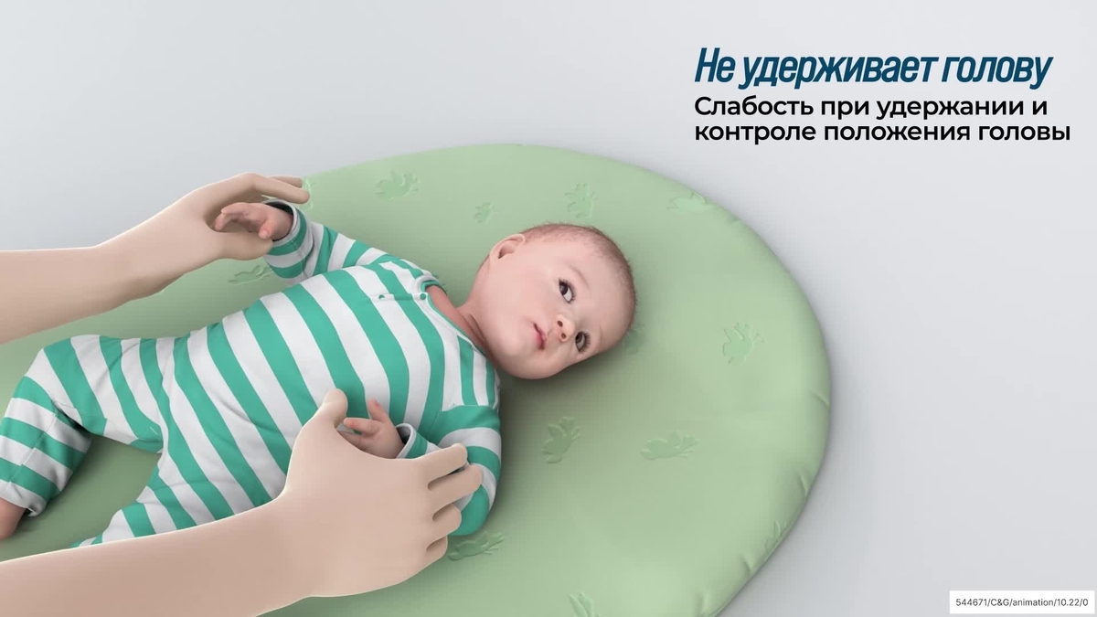 не удерживает голову