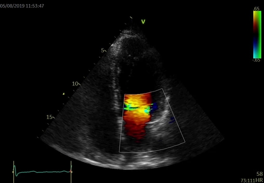 Kazuistiky z III. Cyklu - Nechme srdce bít_5_kazuistika_Video_5B_Dr_Hlubocka