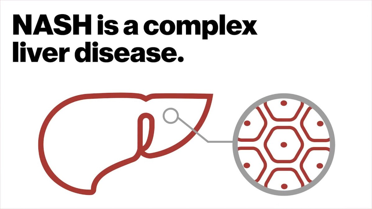 Multipronged approach for complex liver disease