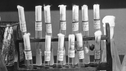 Tıp Tarihinde On Muhteşem Dönüm Noktası