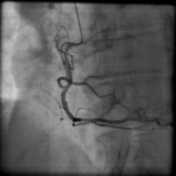 Kazuistiky z III. Cyklu - Nechme srdce bít_5_kazuistika_Video_3B_Dr_Hlubocka