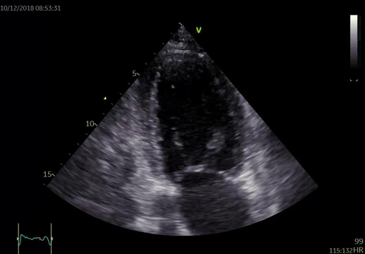 Kazuistiky z III. Cyklu - Nechme srdce bít_5_kazuistika_Video_1B_Dr_Hlubocka