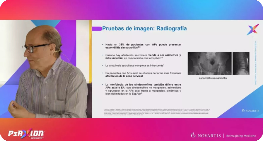 Vídeo_PsAXion_ponencia_Dr.Eugenio_De_Miguel_diagnóstico_imagen_APsaxial