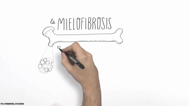 Conociendo la mielofibrosis - FA-11588092