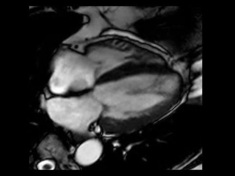 Kazuistiky z III. Cyklu - Nechme srdce bít_5_kazuistika_Video_4_Dr_Hlubocka