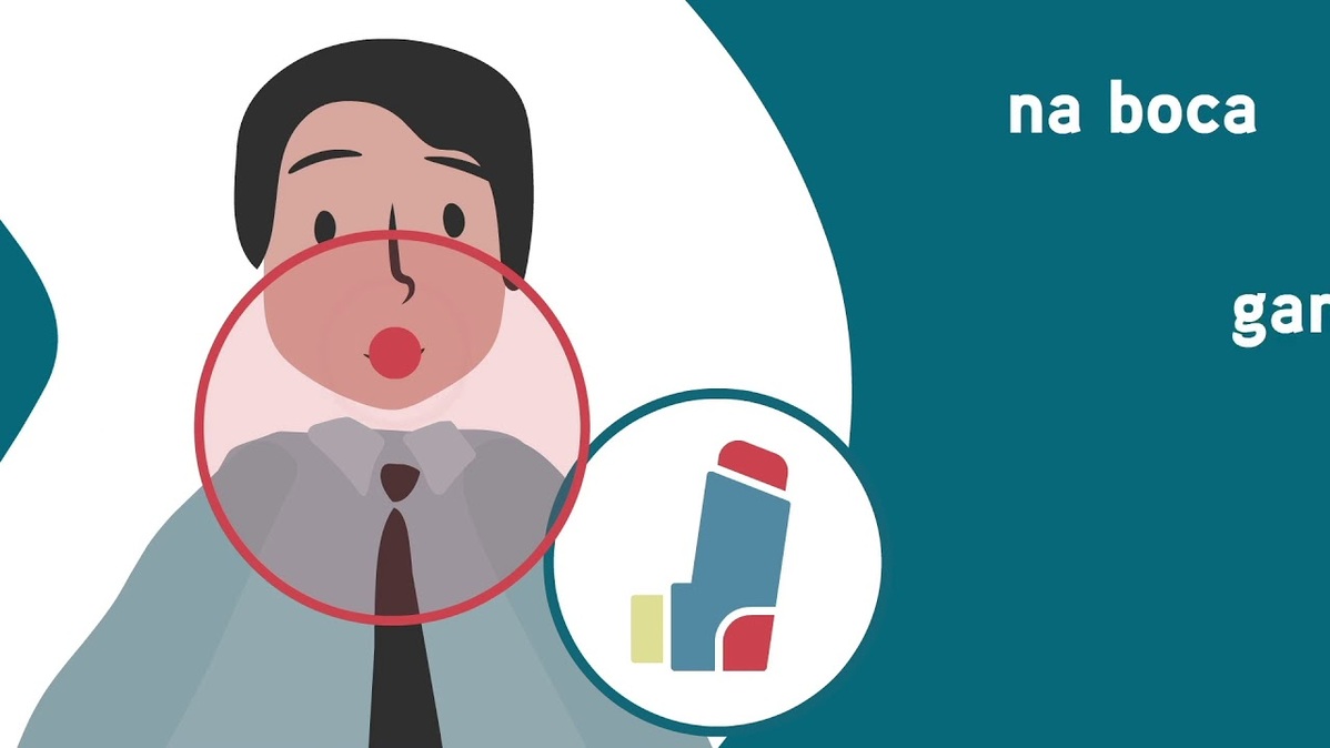 Mito 4 - Os corticoides inalados engordam?