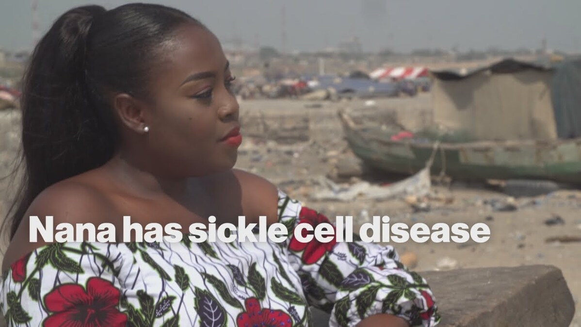 Nana has sickle cell disease