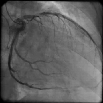 Kazuistiky z III. Cyklu - Nechme srdce bít_5_kazuistika_Video_3A_Dr_Hlubocka