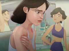 Watch Uninvited Guest— Social Impact of chronic spontaneous Urticaria. Play video.
