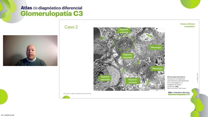 Renal_Fabhalta_CCComplejospAtlasGC3