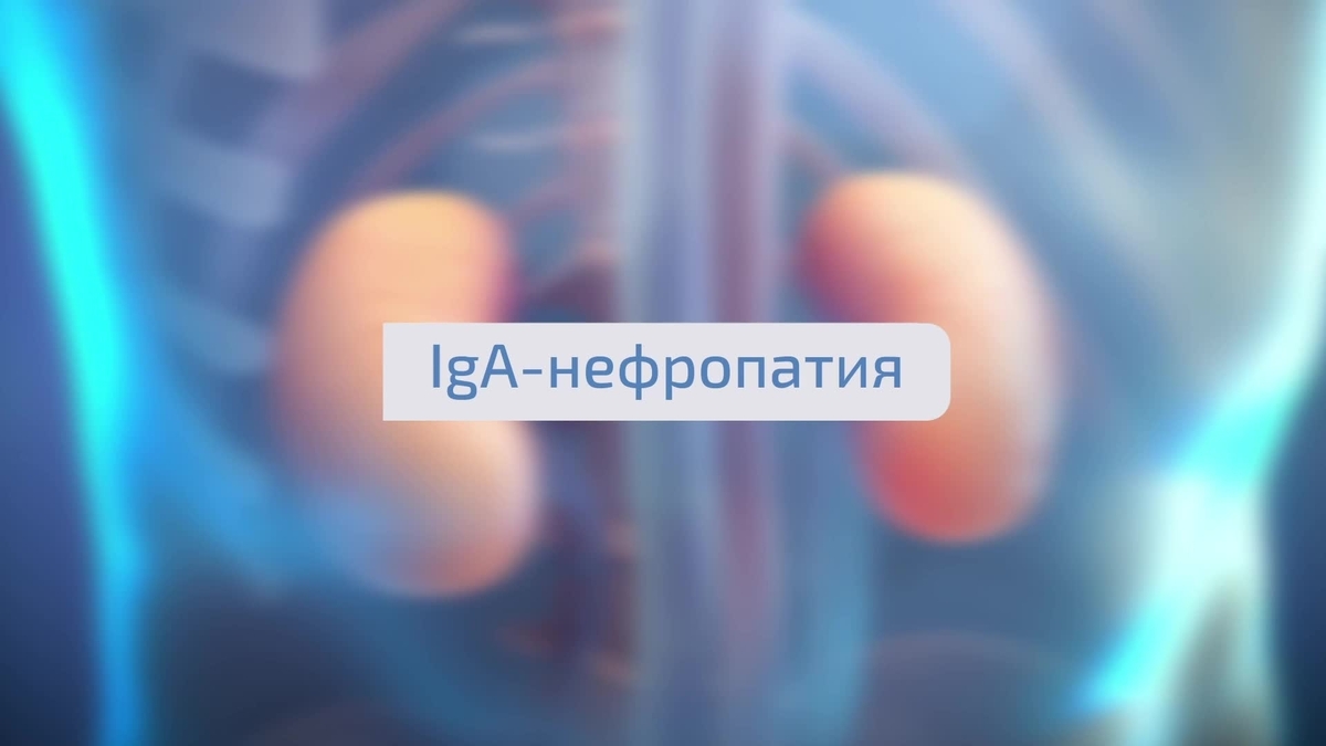 IGA_short_02