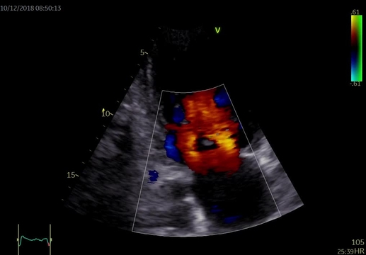 Kazuistiky z III. Cyklu - Nechme srdce bít_5_kazuistika_Video_2_Dr_Hlubocka