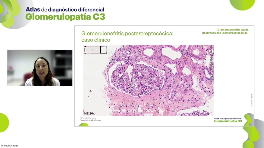 Renal_Fabhalta_Ficha8GNagudapostinfeccAtlasGC3