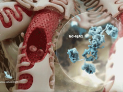 Explore the Pathogenesis of IgAN