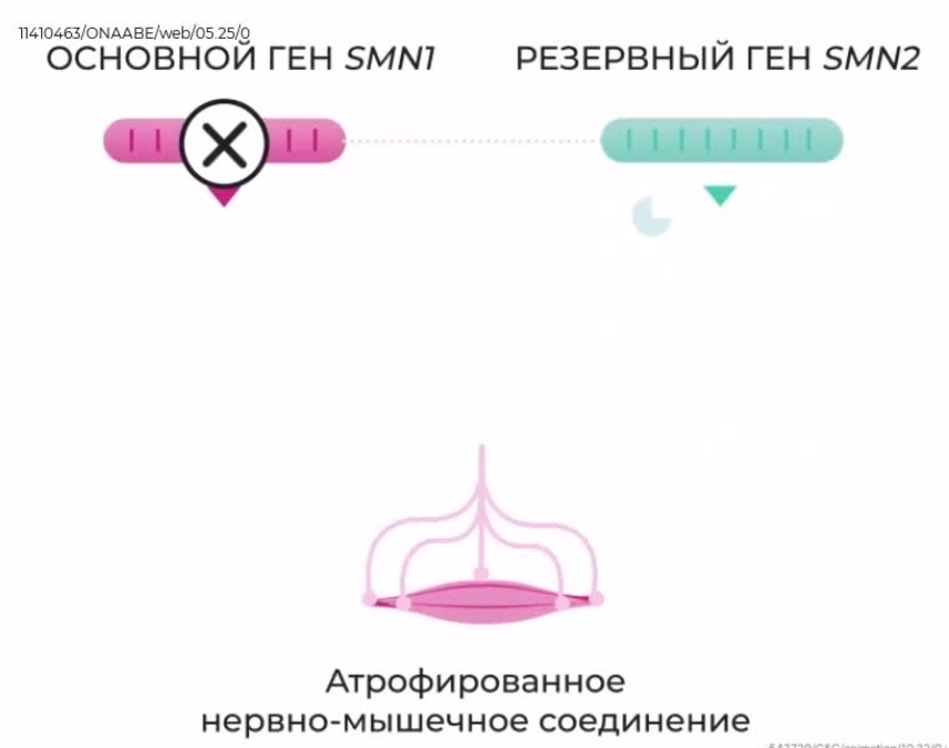 Ребенок со СМА1