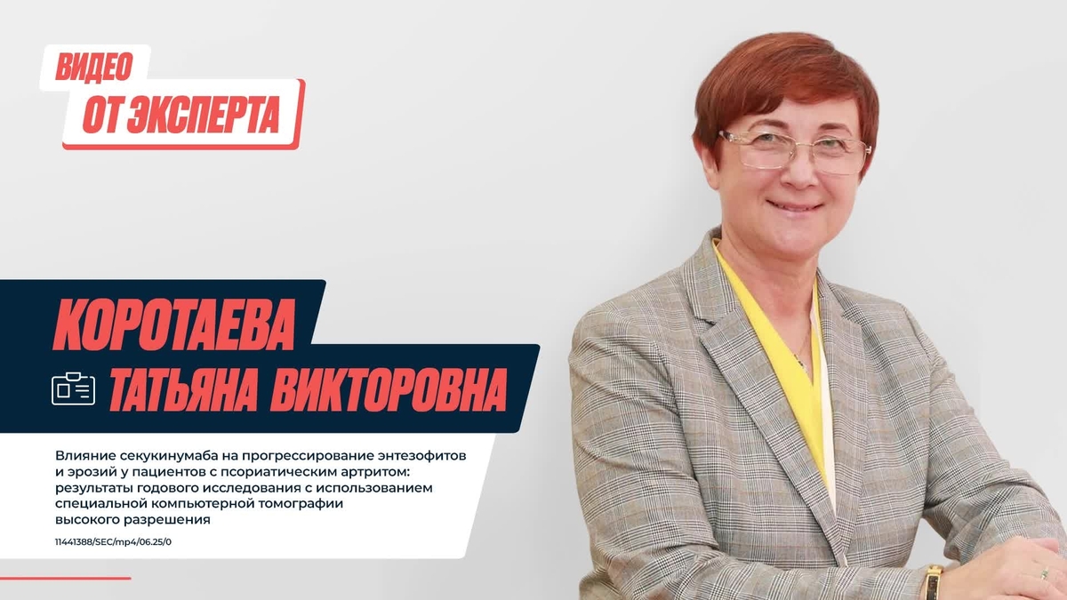 Коротаева Т.В. Влияние секукинумаба на прогрессирование энтезофитов и эрозий у пациентов с ПсА