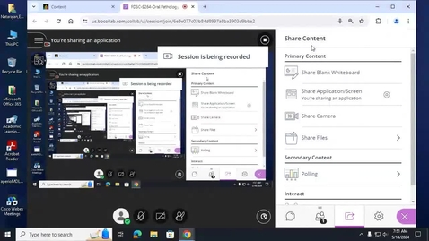 Thumbnail for OP23, 24 - Oral Cancer II &amp; Cancer in Bone