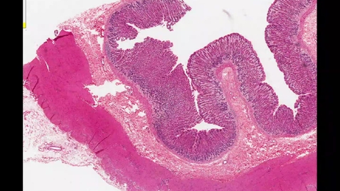 Thumbnail for Approach to the Stomach