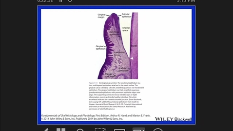 Thumbnail for Tooth Eruption and Dentogingival Attachment