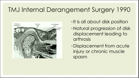 Thumbnail for FDSC-9459 Pharmacologic management of Chronic Oro-facial Pain &amp; Surgery