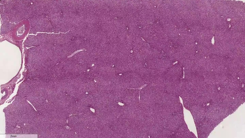 Thumbnail for Approach to the LIver