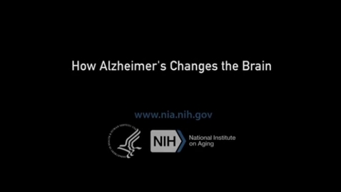 Thumbnail for entry How Alzheimer's Changes the Brain, VITAL