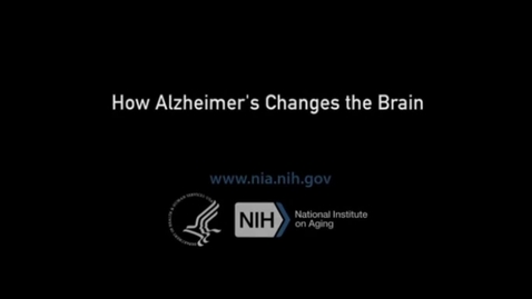 Thumbnail for How Alzheimer's Changes the Brain, VITAL