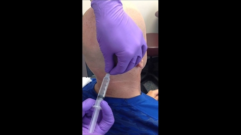 Thumbnail for Occipital Nerve Block:  Dr Andrew Blumenfeld