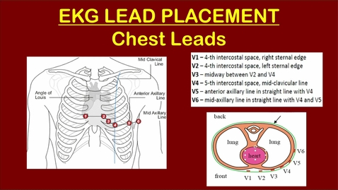 Thumbnail for Kickoff: EKGs 