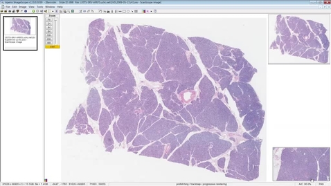 Thumbnail for Approach to the Pancreas