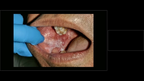 Thumbnail for GOP-13