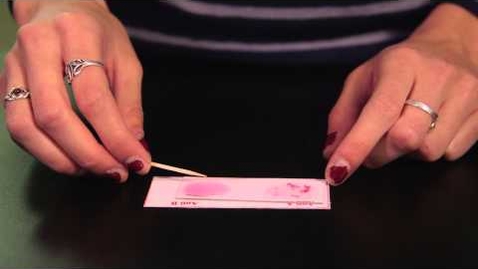Thumbnail for Blood Typing Lab