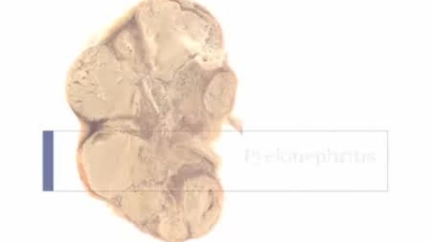 Thumbnail for entry PathologyModule_Pyelonephritis