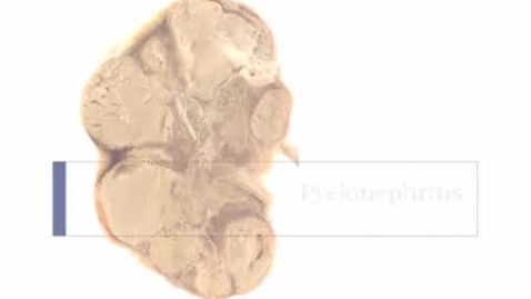 Thumbnail for PathologyModule_Pyelonephritis