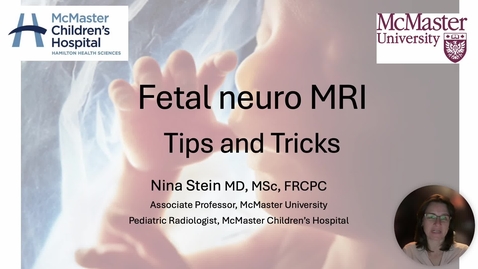Thumbnail for Fetal MRI lecture 2024 with recording copy