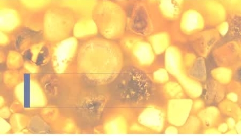 Thumbnail for PathologyModule_Gallstones