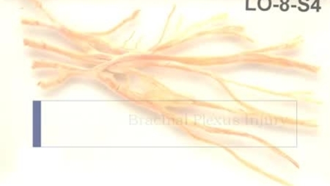 Thumbnail for PathologyModule_BrachialPlexusInjury