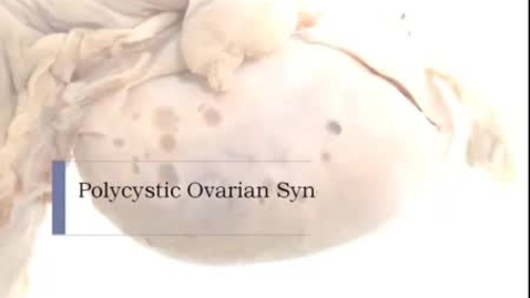 Thumbnail for PathologyModule_PolycysticOvarianSyndrome
