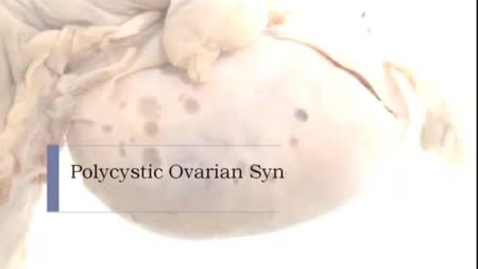 Thumbnail for entry PathologyModule_PolycysticOvarianSyndrome