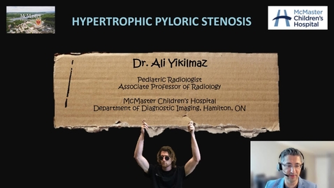Thumbnail for entry Hypertrophic pyloric stenosis