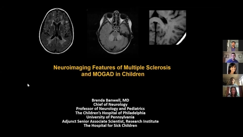 Thumbnail for entry Neuroimaging Features of Multiple Sclerosis and MOGAD in Children, Dr. Brenda Banwell, August 27 2021