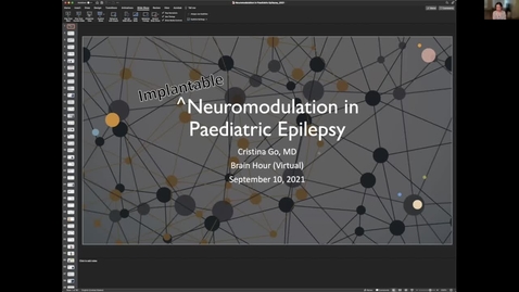 Thumbnail for Neuromodulation in Epilepsy, Dr. Cristina Go, September 10 2021