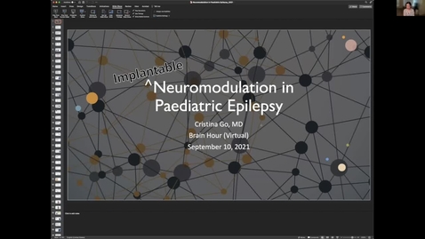 Thumbnail for entry Neuromodulation in Epilepsy, Dr. Cristina Go, September 10 2021